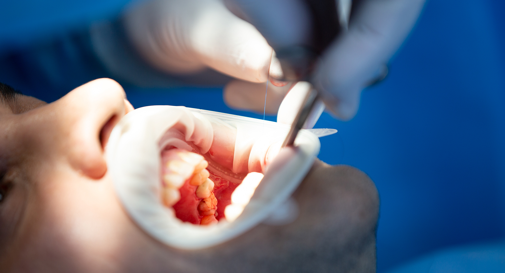 Why should we not ignore dental problems?